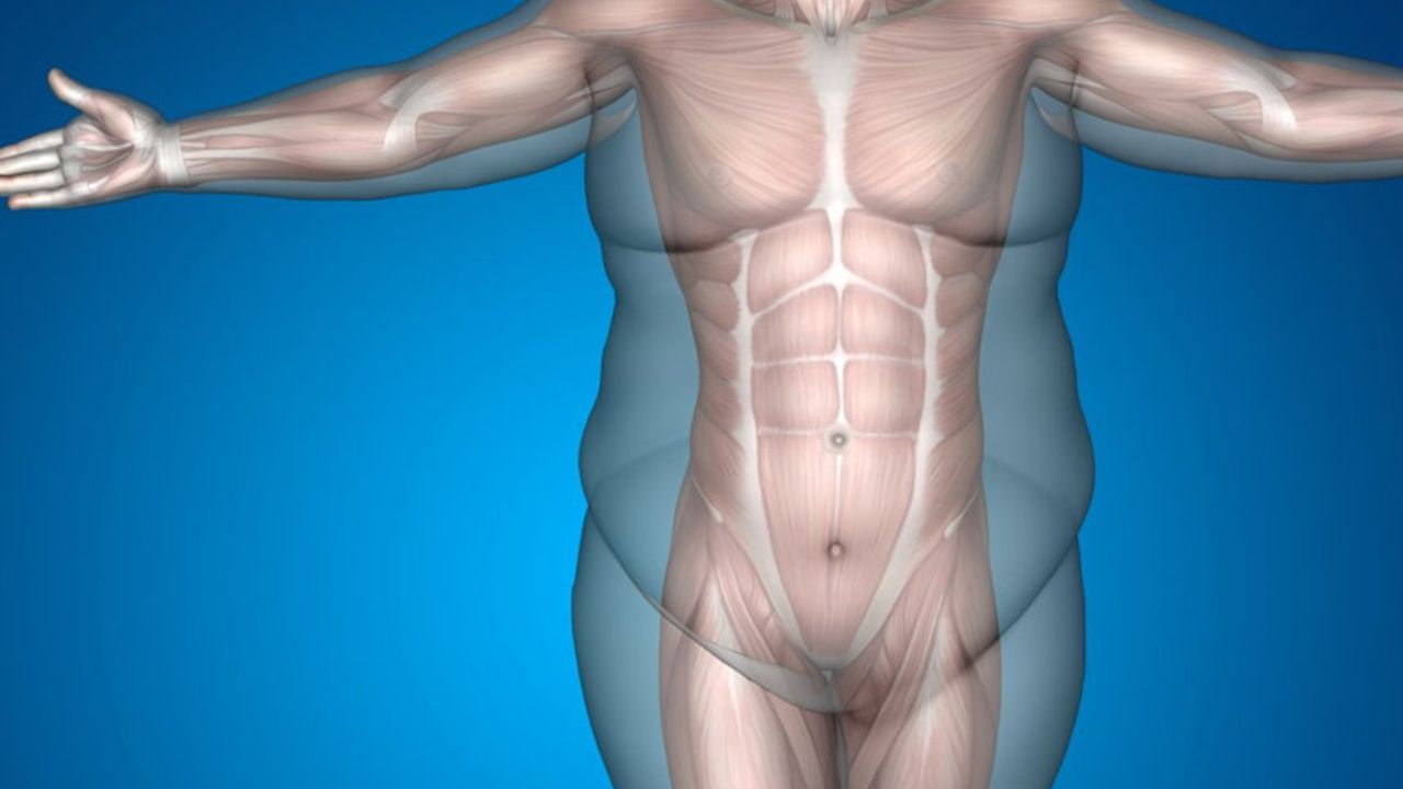 Liposuction nedir, nasıl ve kimlere yapılır? Liposuction tehlikeli midir?