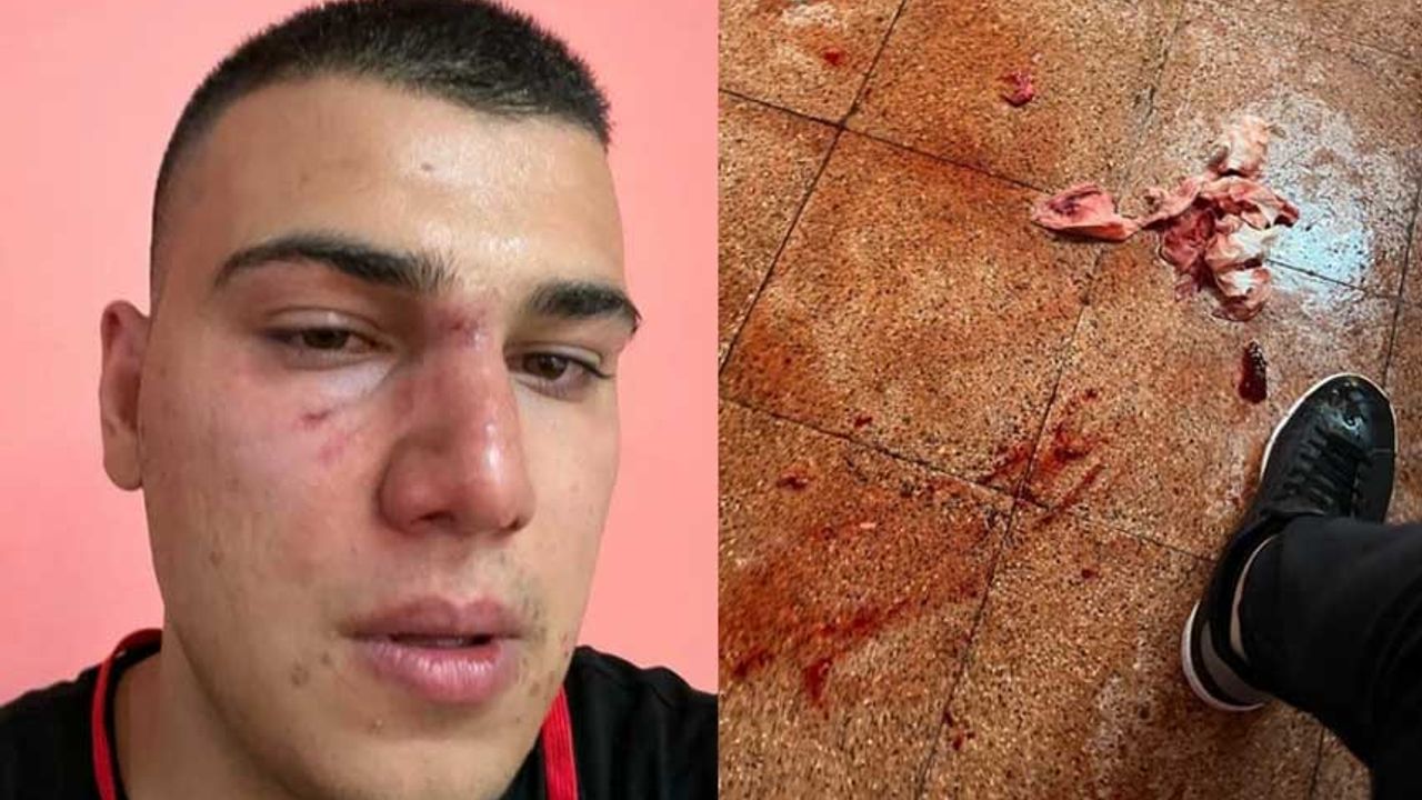 'Değişim' isteyen CHP Gençlik Kolları üyeleri dövüldü