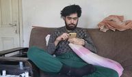 Hatay’da sanal bağımlı bir genç, 3 yıldır evden çıkmıyor, banyo yapmıyor, sadece telefon ve bilgisayarla yaşıyor