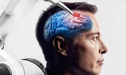 Elon Musk'ın beyin çipi şirketi Neuralink insan testlerine başlıyor!