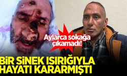 Bir sinek ısırığıyla hayatı kararmıştı! Yaşadıklarını böyle anlattı...