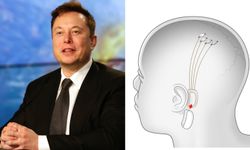 Elon Musk'ın beyin çipi projesi, insan deneyleri için FDA'dan onay aldı