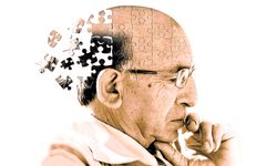 Alzheimer aşısında yeni gelişme! Sonuçlar paylaşıldı!