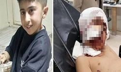 Ekmek almaya giderken başıboş sokak köpeklerinin saldırdığı çocuk ağır yaralandı