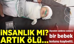 İsrail saldırısında kolu kopan bebek!