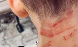 Burdur’da özel gereksinimli çocuğa darp: Soruşturma açıldı