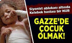 Gazze'de Siyonist İsrail ablukası altında kelebek hastası küçük Nur, tedavi olacağı günleri bekliyor