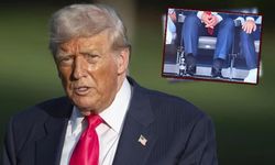 Bacak ve ayaklarındaki şişkinlik dikkat çeken Trump'ın hastalığına teşhis konuldu