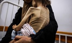Gazze'de açlık soykırımı sürüyor: Küçük Meryem 10 kiloya düştü