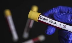 Fransa ilk Ebola vakasını açıkladı