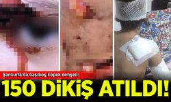 Şanlıurfa'da başıboş köpeklerin saldırısına uğrayan çocuğa 150 dikiş atıldı
