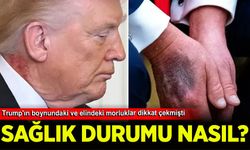 Trump'ın sağlık durumu nasıl? Boynundaki morluklar dikkat çekmişti