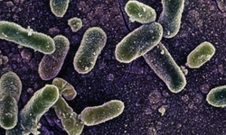 Belçika'da salmonella alarmı: En az 300 kişiye bulaştı