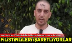 İsrail'den bir skandal daha: Masum sivillere işkence yapıp sayılarla işaretlediler