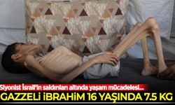 Siyonist İsrail'in saldırıları sürüyor! Gazzeli İbrahim’in yaşam mücadelesi…