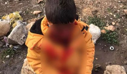Başıboş köpek terörü devam ediyor!