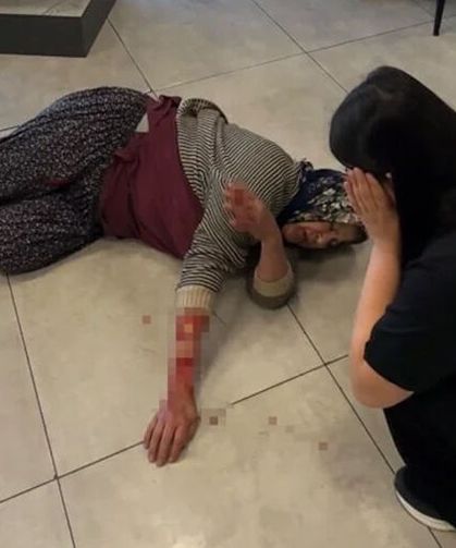 Afyonkarahisar'da başıboş köpek kadının kolunu kopardı