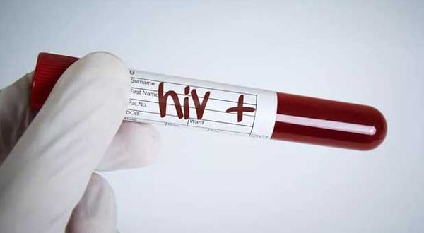 Türkiye'de 32 bin kişi HIV ile yaşıyor