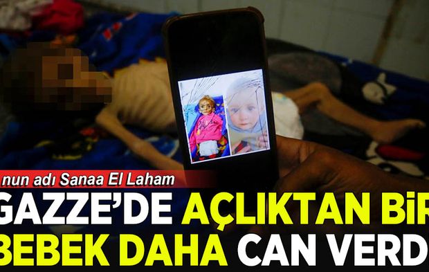 Gazze'de açlıktan bir bebek daha can verdi