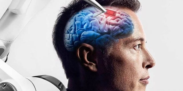 Musk'tan 'Neuralink' açıklaması: Ölümcül hasta maymunları seçtik