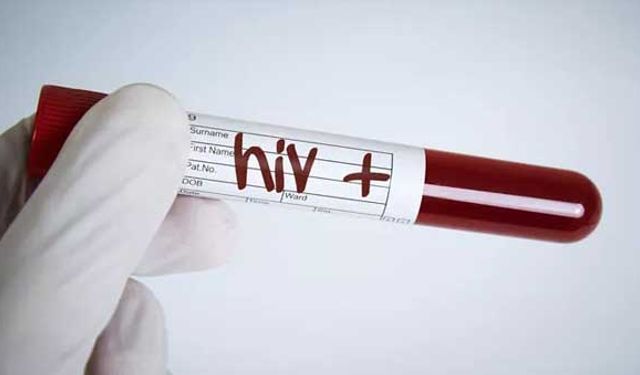 Adeta bir salgın gibi! Türkiye'de HIV artış eğiliminde