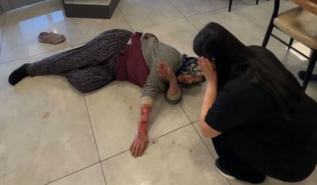 Afyonkarahisar'da başıboş köpek kadının kolunu kopardı