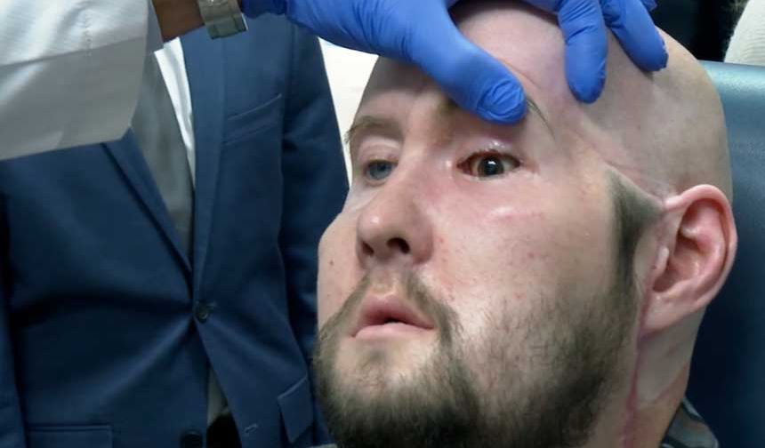 Dünyanın ilk göz nakli ameliyatı gerçekleştirildi