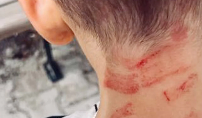 Burdur’da özel gereksinimli çocuğa darp: Soruşturma açıldı