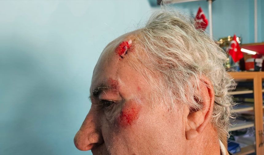 Burdur'da sokak köpeklerinin saldırdığı kişi yaralandı