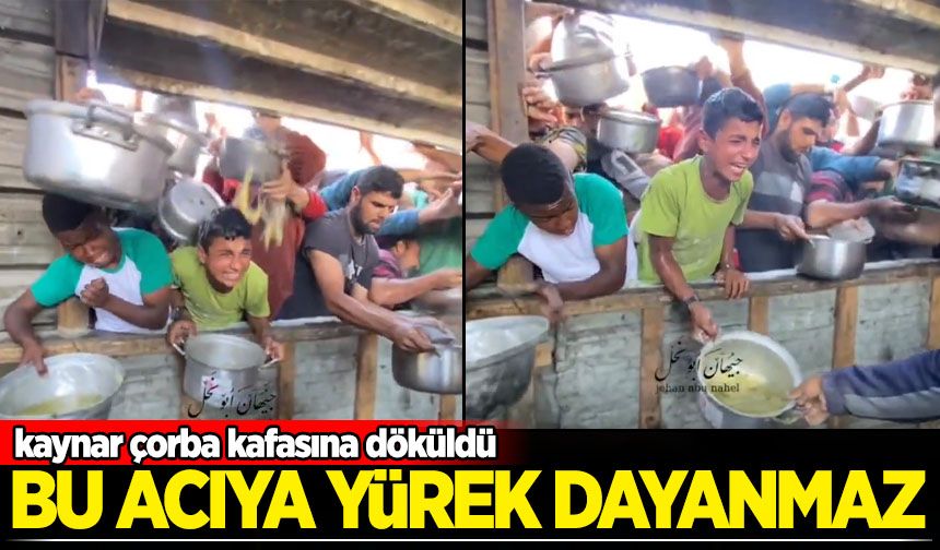 Kaynar çorba kafasına döküldü! Bu acıya yürek dayanmaz
