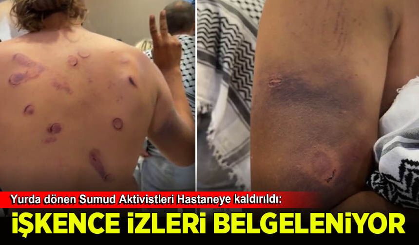 Yurda dönen Sumud Aktivistleri Hastaneye kaldırıldı: İşkencenin izleri belgeleniyor!