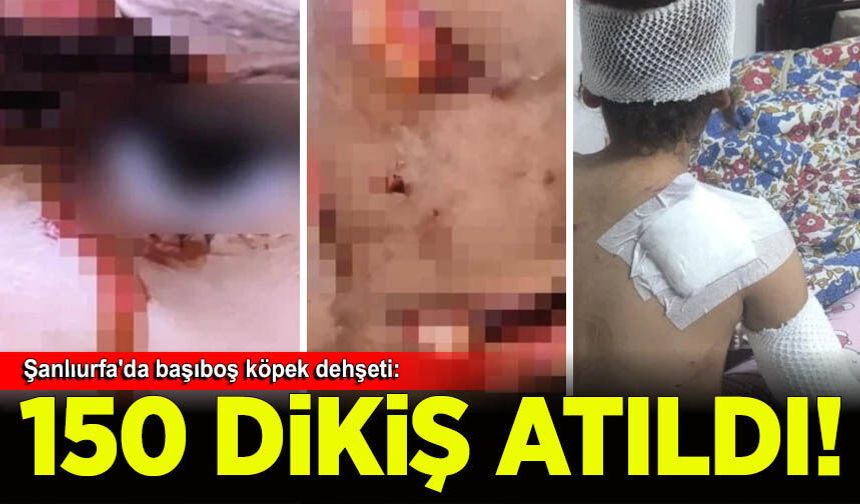 Şanlıurfa'da başıboş köpeklerin saldırısına uğrayan çocuğa 150 dikiş atıldı