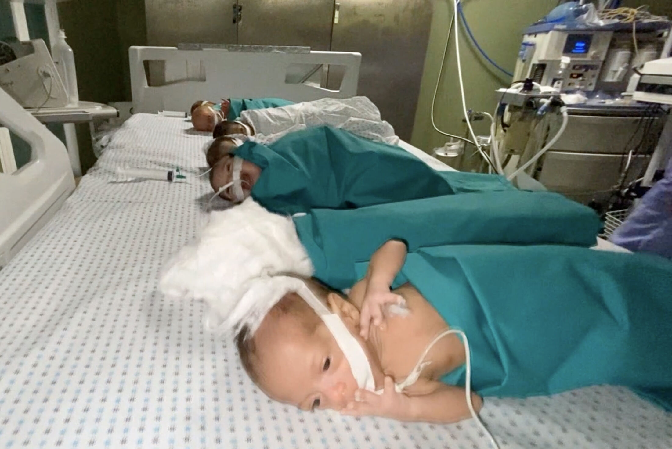 AA-20231114-32880963-32880955-SIFA_HASTANESINDEKI_PREMATURE_BEBEKLER_KUVOZDEN_CIKARTILDI