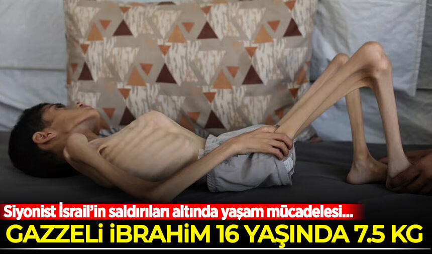 Siyonist İsrail'in saldırıları sürüyor! Gazzeli İbrahim’in yaşam mücadelesi…